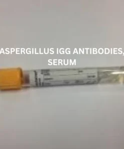 ASPERGILLUS IGG ANTIBODIES, SERUM