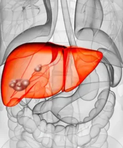 Hydatid Serology (Echinococcus, Igg)