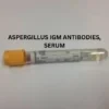 ASPERGILLUS IGM ANTIBODIES, SERUM