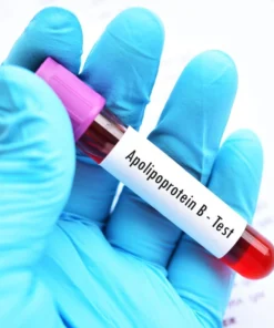 APOLIPOPROTEIN- B, SERUM