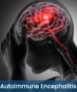AUTOIMMUNE ENCEPHALITIS PANEL