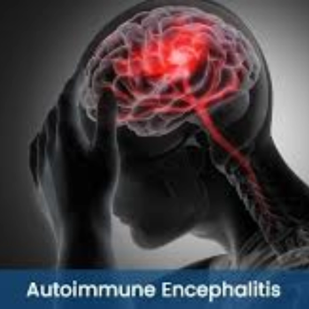 AUTOIMMUNE ENCEPHALITIS PANEL