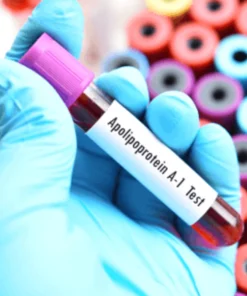 APOLIPOPROTEIN- A1, SERUM