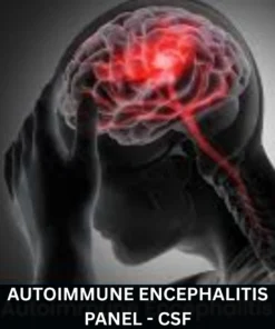 AUTOIMMUNE ENCEPHALITIS PANEL - CSF