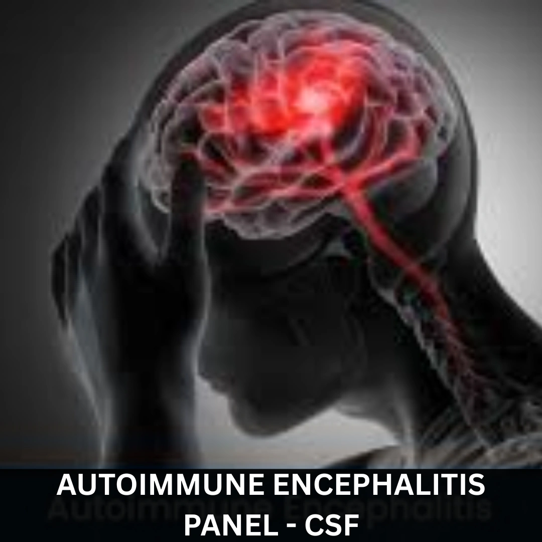 AUTOIMMUNE ENCEPHALITIS PANEL - CSF