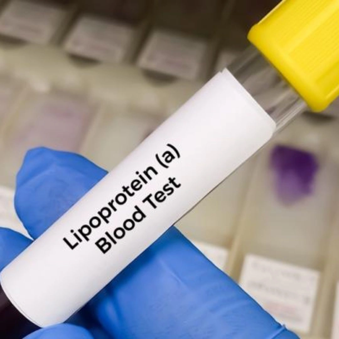 Lipoprotein A(Lpa), Serum