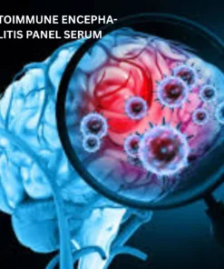 AUTOIMMUNE ENCEPHA- LITIS PANEL SERUM