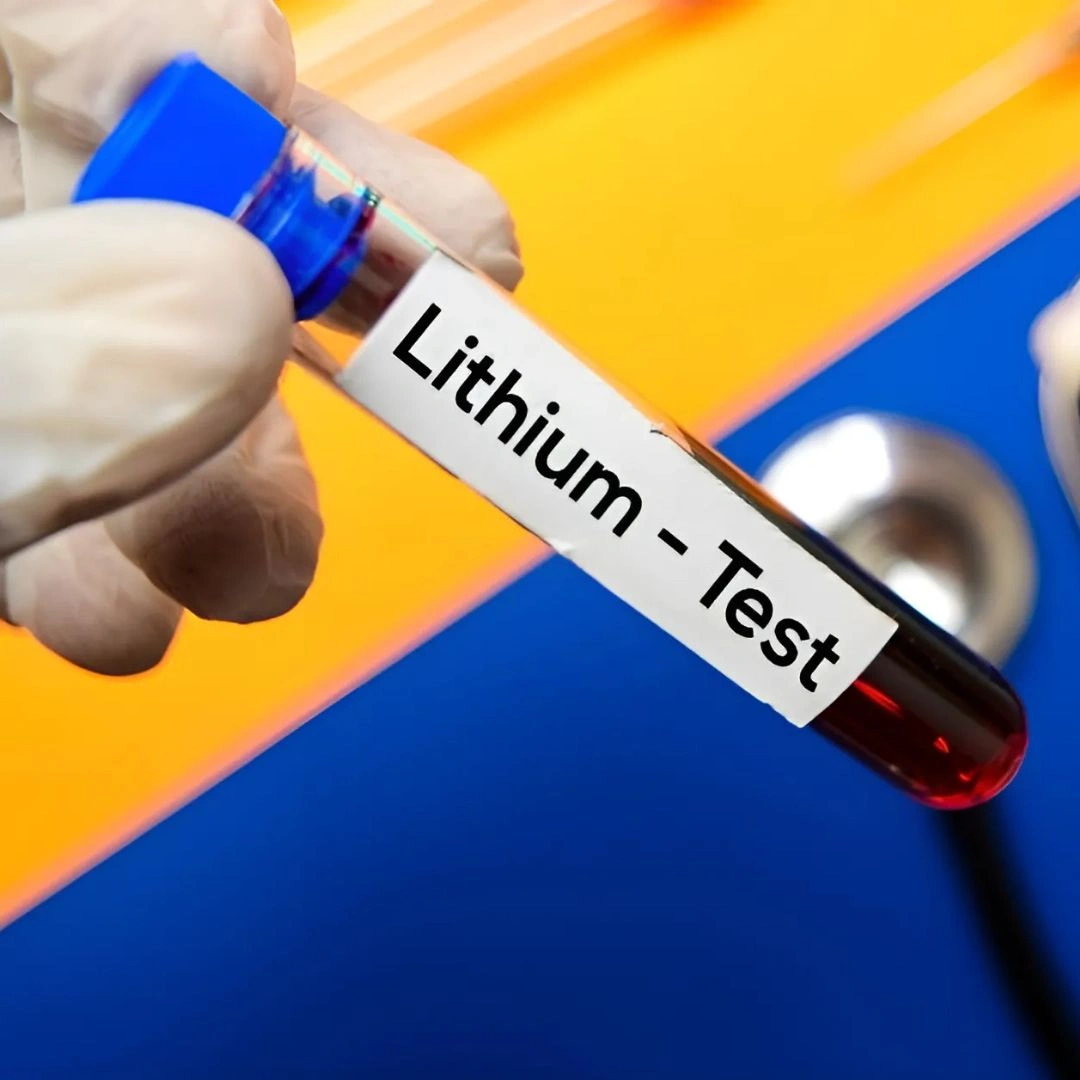 Lithium, Serum