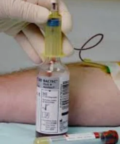 AUTOMATED BLOOD CULTURE-AEROBIC (BACTEC)