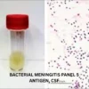 BACTERIAL MENINGITIS PANEL 5 ANTIGENS, SERUM