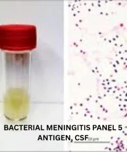 BACTERIAL MENINGITIS PANEL 5 ANTIGENS, SERUM