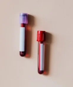 ANTI STREPTOLYSIN O QUANTITATIVE,SERUM