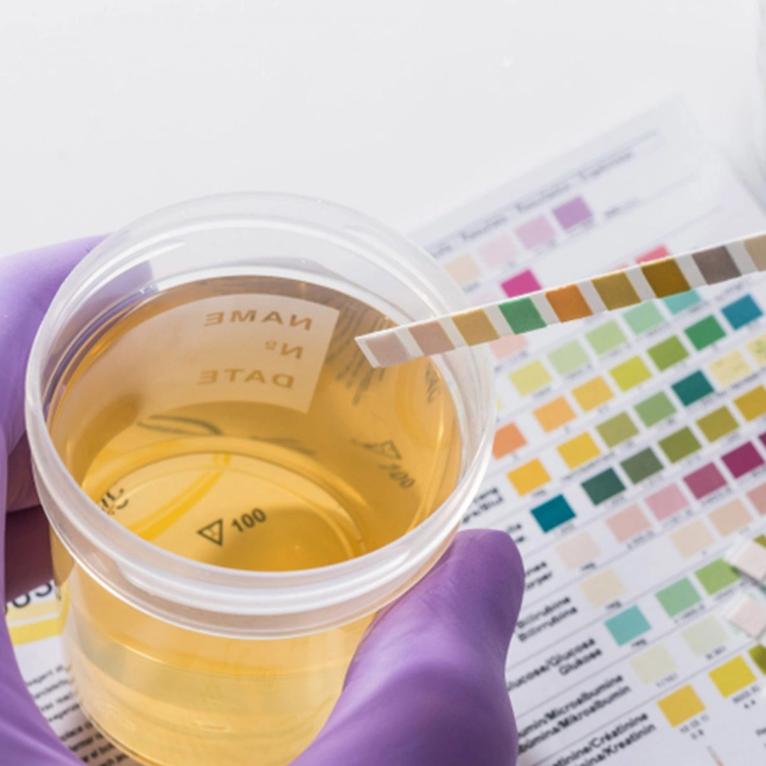 URINE ROUTINE EXAMINATION