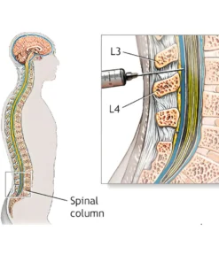 BODY FLUID CULTURE ( EXCEPT CSF )