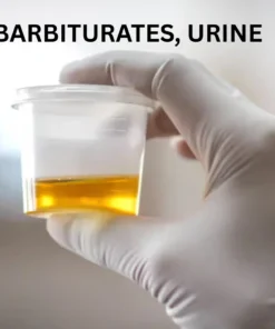 BARBITURATES, URINE