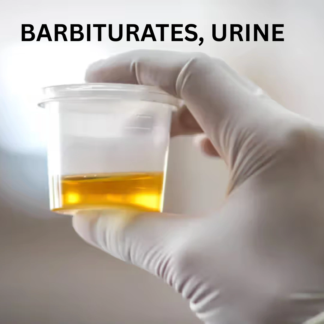 BARBITURATES, URINE