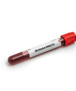 ANTINUCLEAR ANTIBODY SCREEN (ANA), IFA