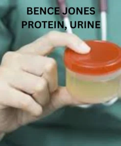 BENCE JONES PROTEIN, URINE