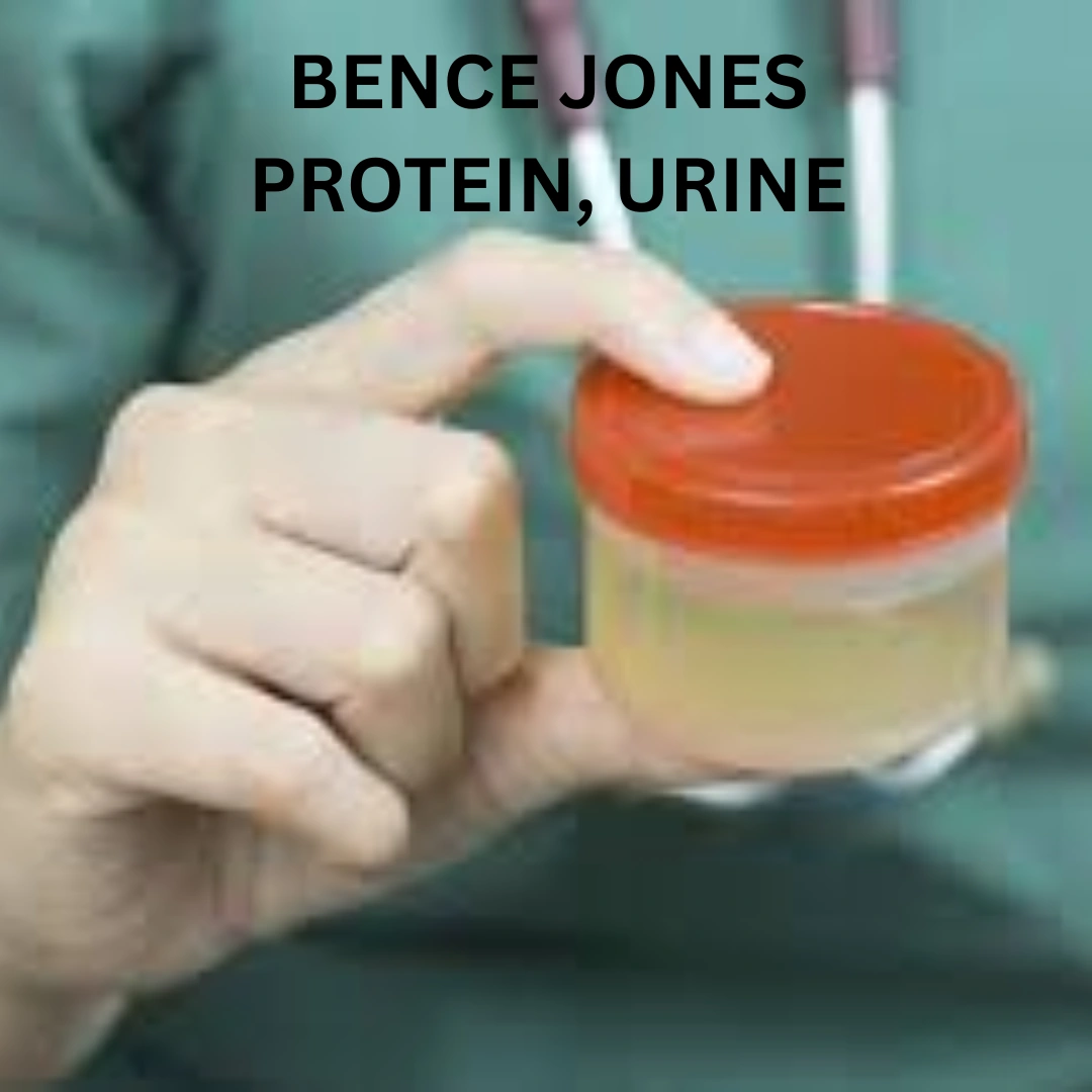 BENCE JONES PROTEIN, URINE