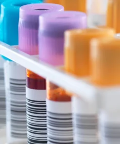 Immunofixation Serum