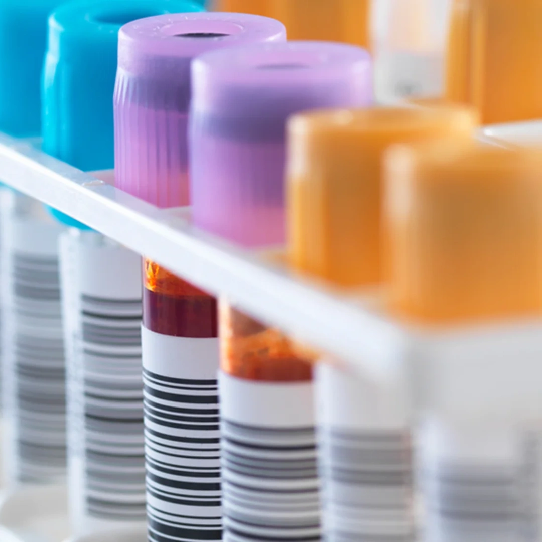 Immunofixation Serum