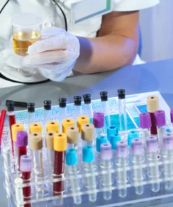 Immunofixation Urine