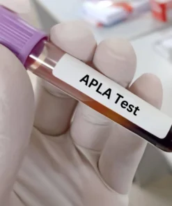 ANTI PHOSPHOLIPID ANTIBODY IGG, SERUM