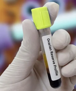 ANTI OVARIAN ANTIBODIES