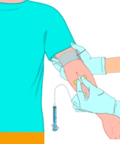 Immunoglobulin G (Igg), Serum