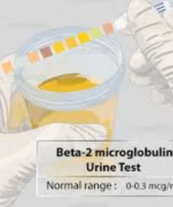 BETA 2 MICROGLOBULIN ( URINE )