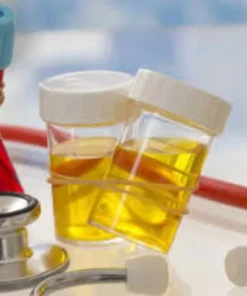 BETA 2 MICROGLOBULIN ( URINE )