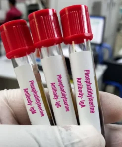 ANTI PHOSPHOLIPID ANTIBODY IGM, SERUM