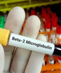 BETA 2 MICROGLOBULIN, SERUM