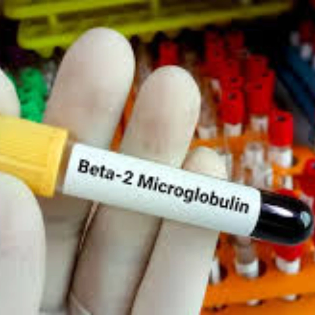BETA 2 MICROGLOBULIN, SERUM