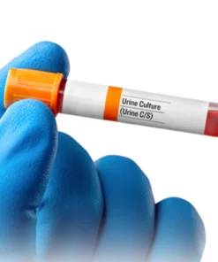 URINE CULTURE & SUSCEPTIBILITY