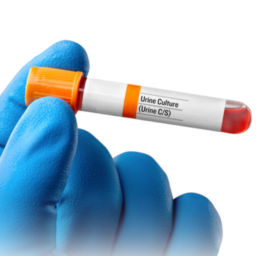 URINE CULTURE & SUSCEPTIBILITY