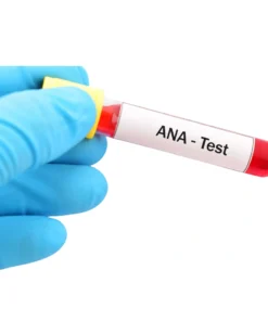 ANTI NUCLEAR ANTIBODY (ANA), SERUM