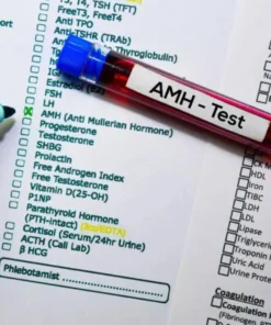 ANTI MULLERIAN HORMONE (AMH), SERUM