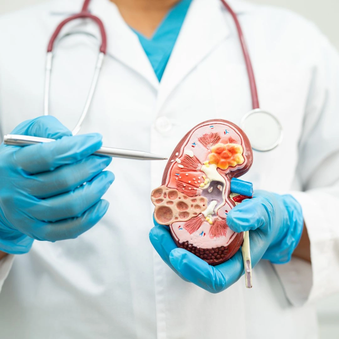 BLOOD UREA NITROGEN (BUN), SERUM