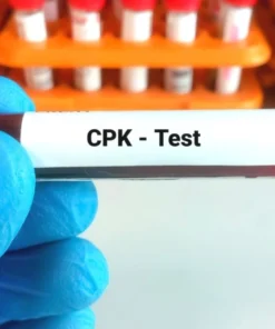 CPK MM FRACTION, SERUM