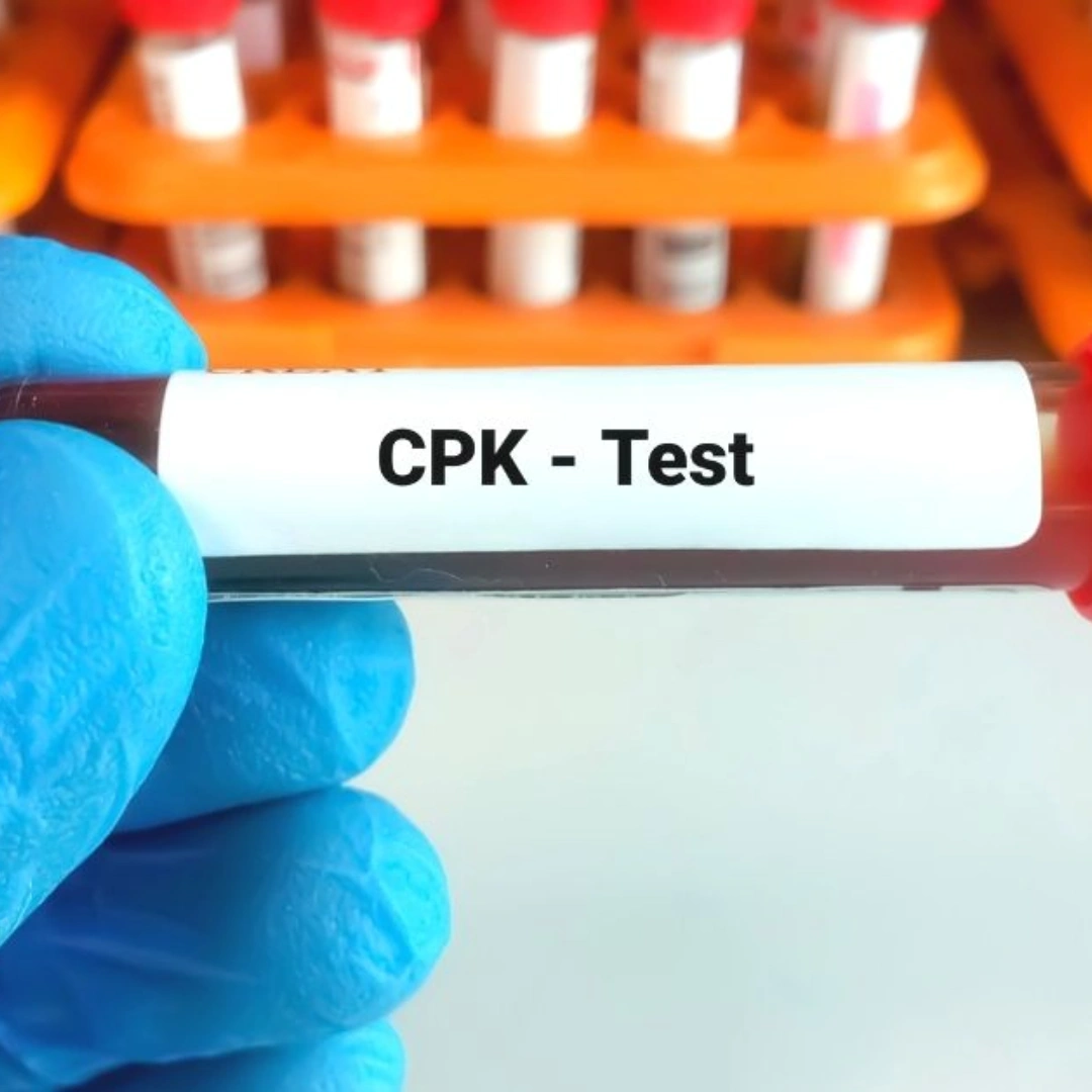 CPK MM FRACTION, SERUM