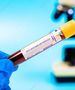 VARICELLA ZOSTER VIRUS (VZV) ANTIBODY, IGG, SERUM