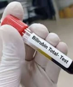 BILIRUBIN TOTAL, SERUM