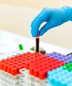 ANTI DNASE B (ANTIDEOXY- RIBONUCLEASE B), SERUM