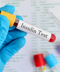 Insulin Fasting, Serum