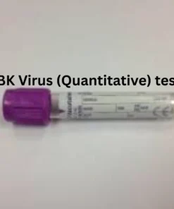 BK VIRUS (QUANTITATIVE)