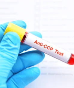 ANTICYCLIC CITRULLINATED PEPTIDE(ANTI CCP),SERUM