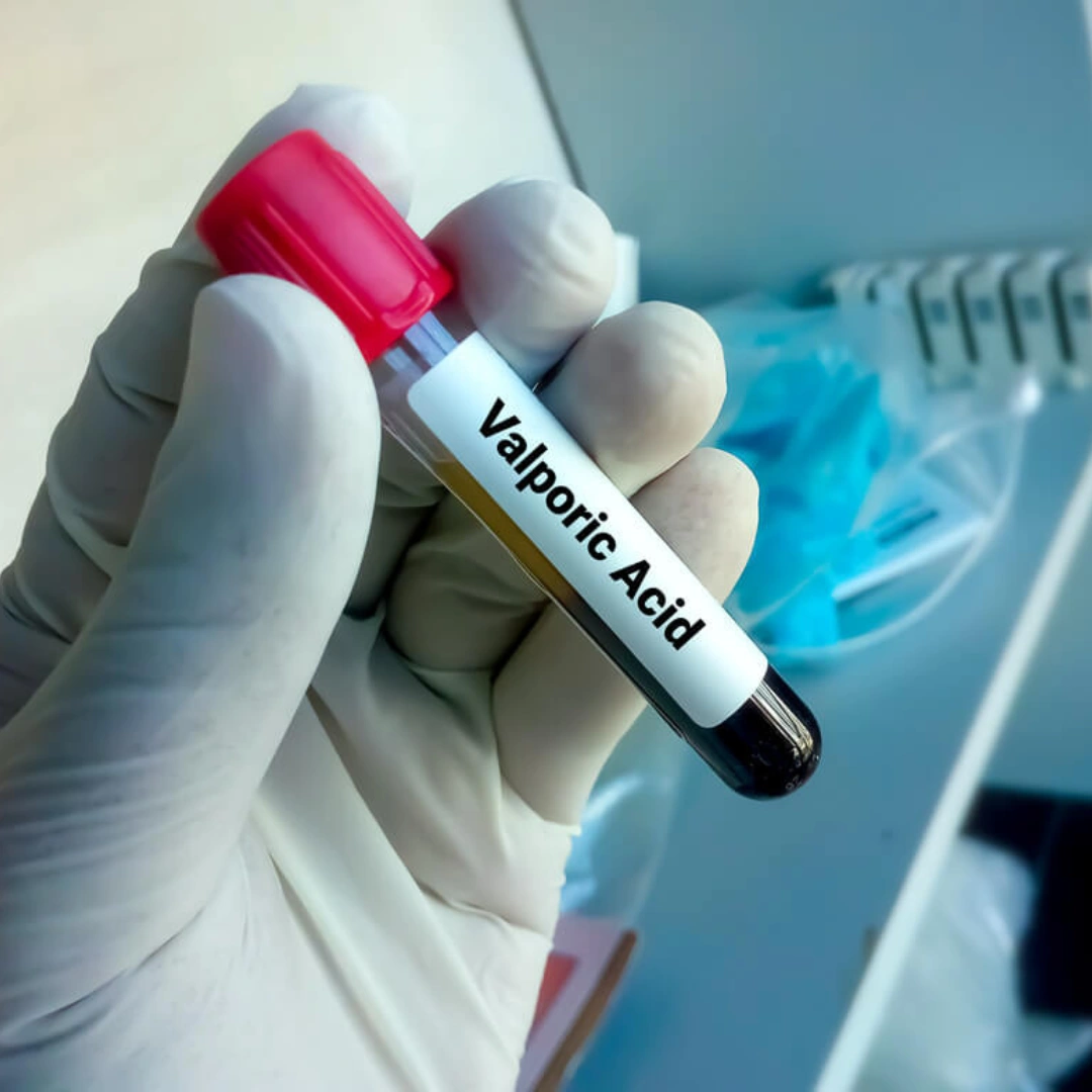 VALPROIC ACID, SERUM
