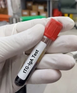 TISSUE TRANSGLUTAMINASE IGA, SERUM