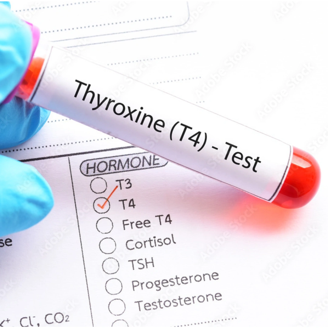 THYROXINE(T4), SERUM